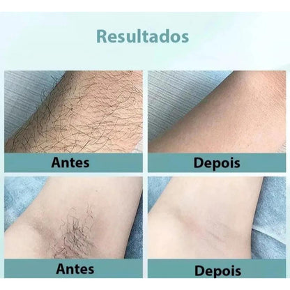 900 Mil Pulsos Depilador A Laser 8 Níveis Portátil Indolor e Eficaz – Uso Doméstico